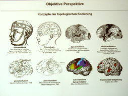 Abbildung des Gehirn